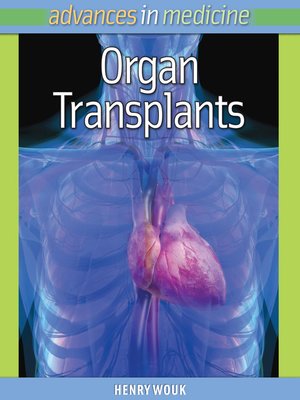 cover image of Organ Transplants